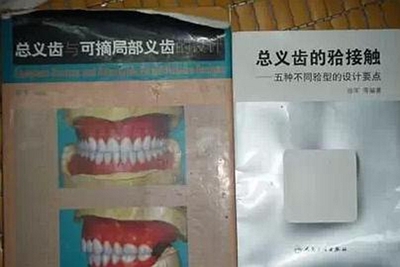 牙槽嵴低平患者进行全口义齿修复